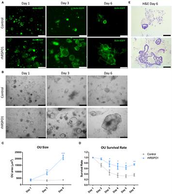 R-Spondin 1 (RSPO1) Increases Mouse Intestinal Organoid Unit Size and Survival in vitro and Improves Tissue-Engineered Small Intestine Formation in vivo